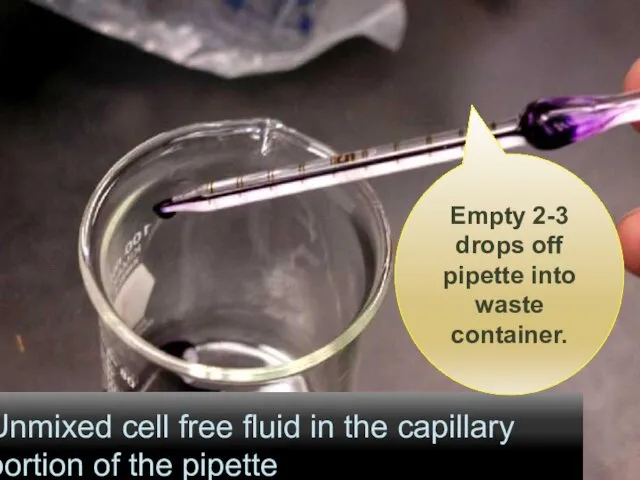 Unmixed cell free fluid in the capillary portion of the pipette Empty 2-3