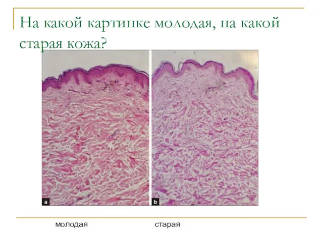 На какой картинке молодая, на какой старая кожа? молодая старая