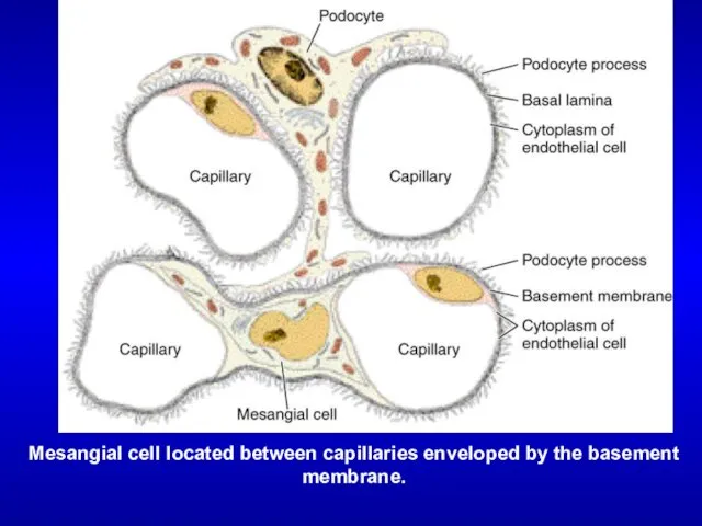 Mesangial cell located between capillaries enveloped by the basement membrane.