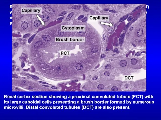 Renal cortex section showing a proximal convoluted tubule (PCT) with