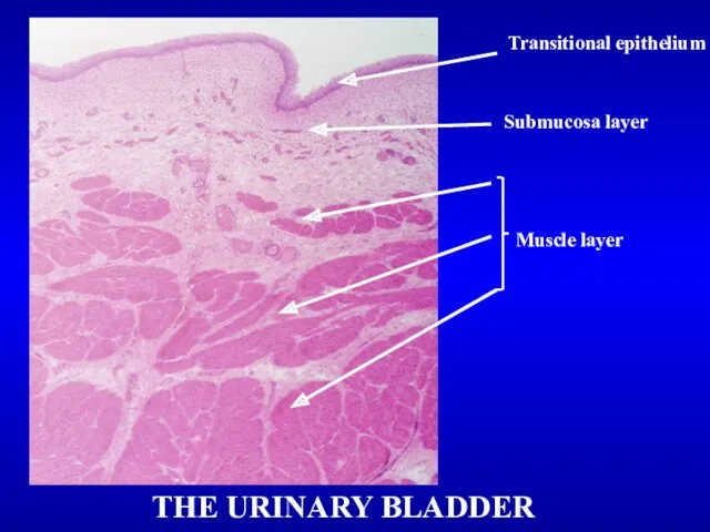 THE URINARY BLADDER Transitional epithelium Submucosa layer Muscle layer