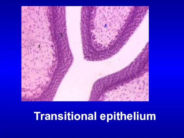 Transitional epithelium