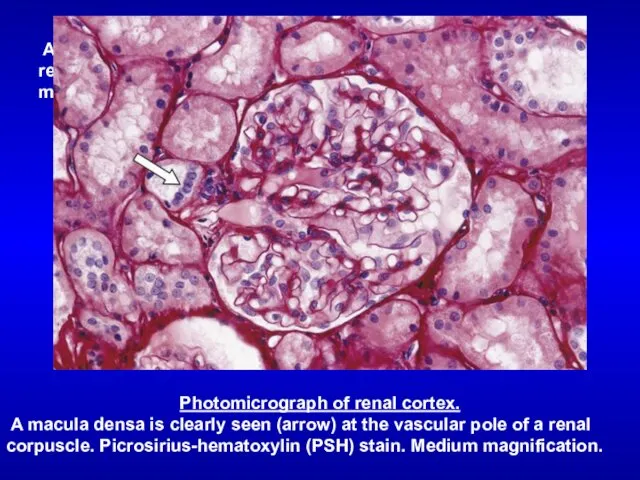 Photomicrograph of renal cortex. A macula densa is clearly seen