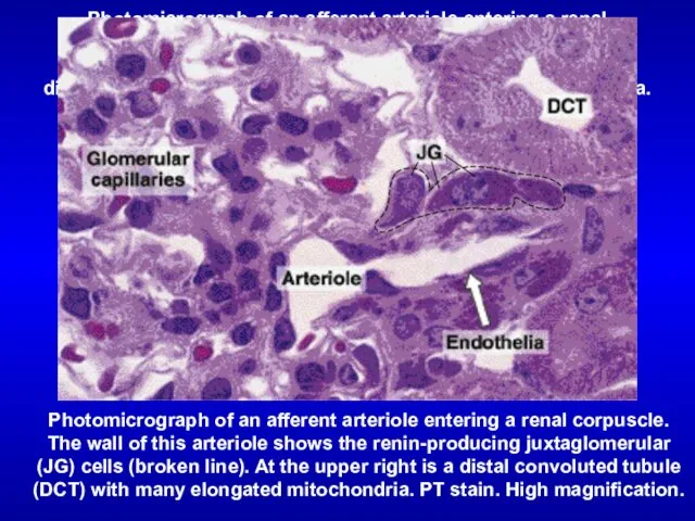 Photomicrograph of an afferent arteriole entering a renal corpuscle. The