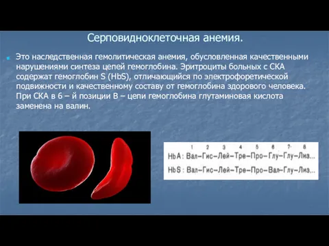 Серповидноклеточная анемия. Это наследственная гемолитическая анемия, обусловленная качественными нарушениями синтеза
