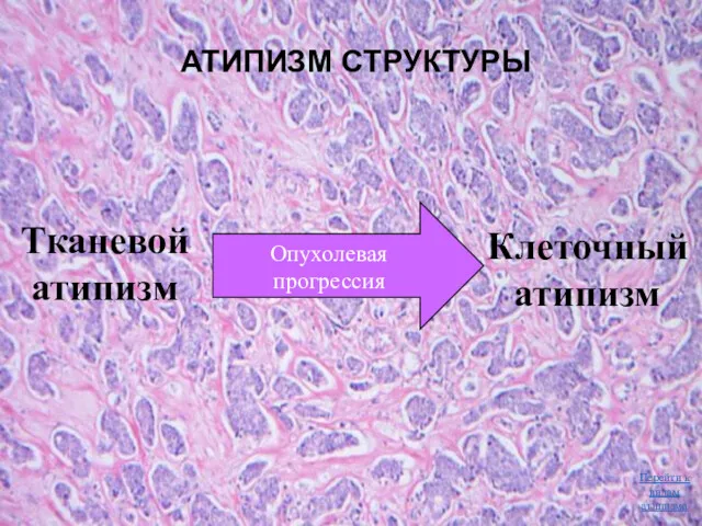 АТИПИЗМ СТРУКТУРЫ Тканевой атипизм Клеточный атипизм Опухолевая прогрессия Перейти к видам атипизма