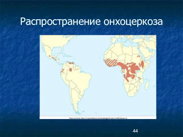 Распространение онхоцеркоза