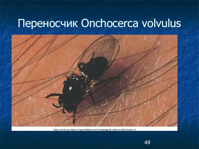 Переносчик Onchocerca volvulus