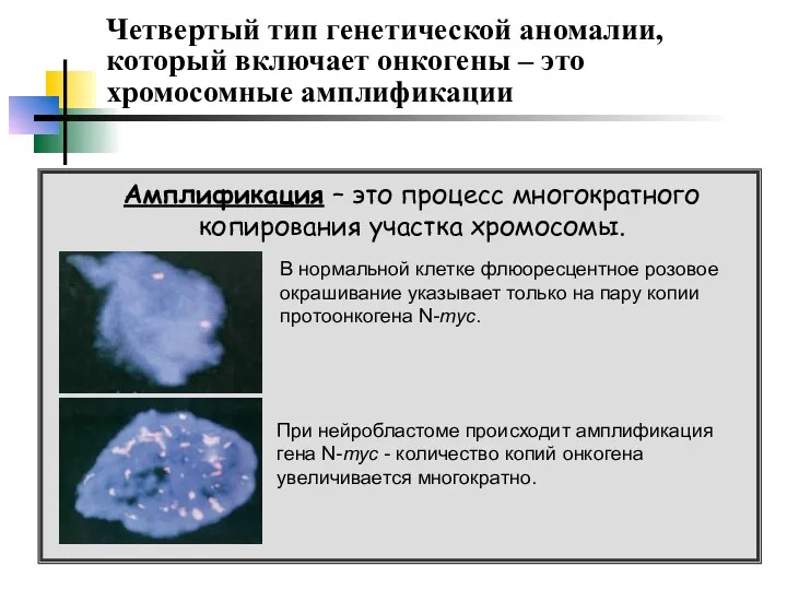 Четвертый тип генетической аномалии, который включает онкогены – это хромосомные амплификации