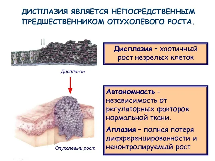 Опухолевый рост Автономность -независимость от регуляторных факторов нормальной ткани. Аплазия