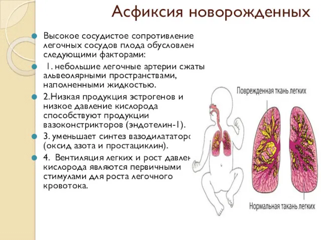 Асфиксия новорожденных Высокое сосудистое сопротивление легочных сосудов плода обусловлен следующими