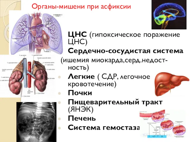 Органы-мишени при асфиксии ЦНС (гипоксическое поражение ЦНС) Сердечно-сосудистая система (ишемия