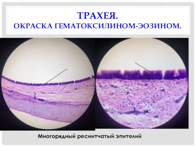 ТРАХЕЯ. ОКРАСКА ГЕМАТОКСИЛИНОМ-ЭОЗИНОМ. Многорядный реснитчатый эпителий