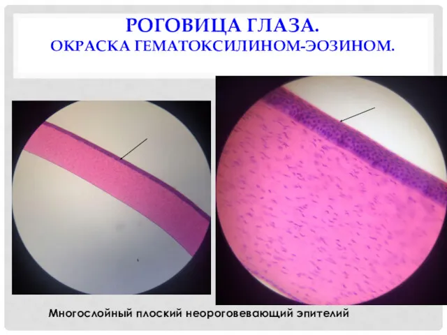 РОГОВИЦА ГЛАЗА. ОКРАСКА ГЕМАТОКСИЛИНОМ-ЭОЗИНОМ. Многослойный плоский неороговевающий эпителий