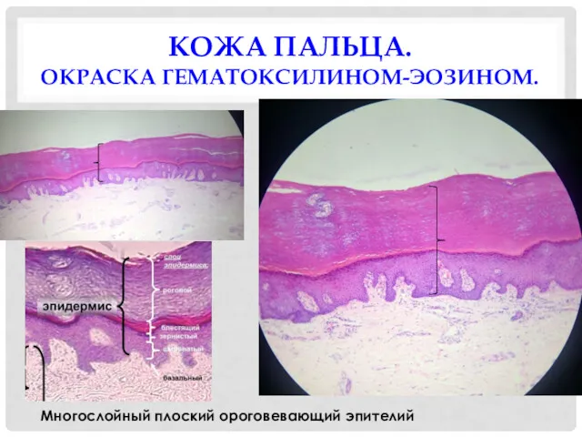 КОЖА ПАЛЬЦА. ОКРАСКА ГЕМАТОКСИЛИНОМ-ЭОЗИНОМ. Многослойный плоский ороговевающий эпителий