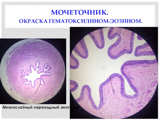 МОЧЕТОЧНИК. ОКРАСКА ГЕМАТОКСИЛИНОМ-ЭОЗИНОМ. Многослойный переходный эпителий