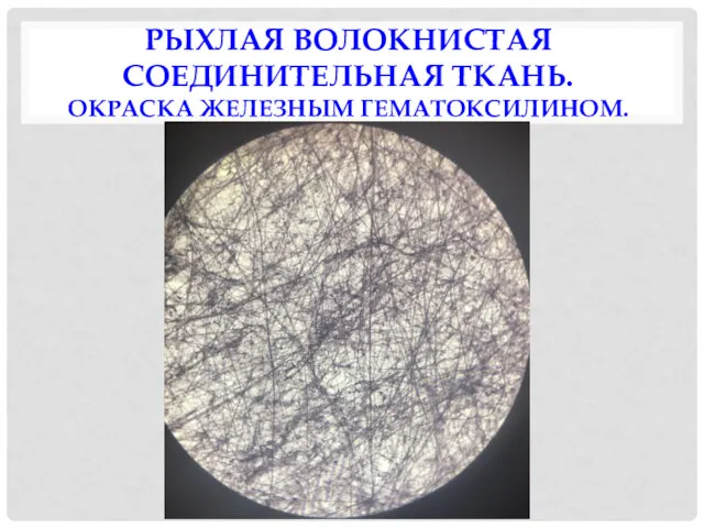 РЫХЛАЯ ВОЛОКНИСТАЯ СОЕДИНИТЕЛЬНАЯ ТКАНЬ. ОКРАСКА ЖЕЛЕЗНЫМ ГЕМАТОКСИЛИНОМ.
