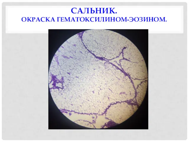 САЛЬНИК. ОКРАСКА ГЕМАТОКСИЛИНОМ-ЭОЗИНОМ.