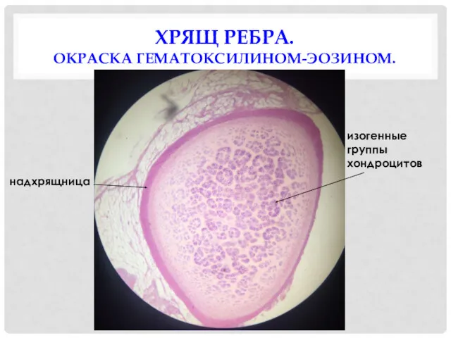 ХРЯЩ РЕБРА. ОКРАСКА ГЕМАТОКСИЛИНОМ-ЭОЗИНОМ. изогенные группы хондроцитов надхрящница