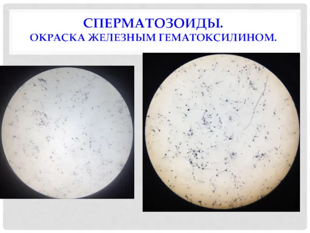 СПЕРМАТОЗОИДЫ. ОКРАСКА ЖЕЛЕЗНЫМ ГЕМАТОКСИЛИНОМ.