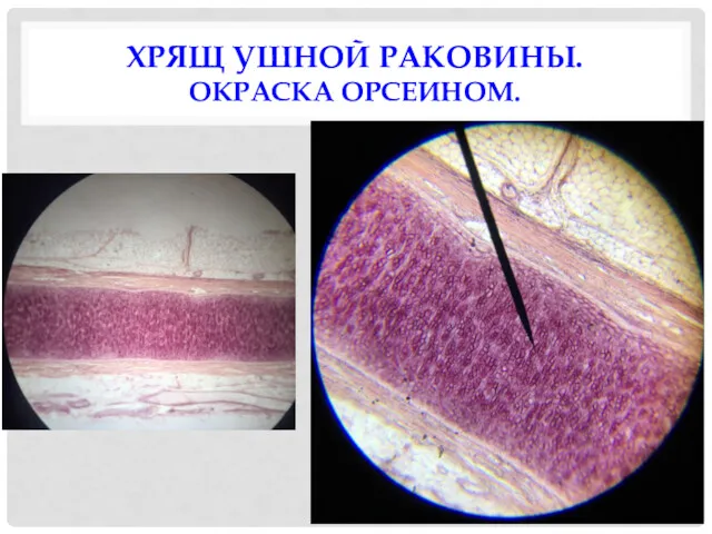 ХРЯЩ УШНОЙ РАКОВИНЫ. ОКРАСКА ОРСЕИНОМ.