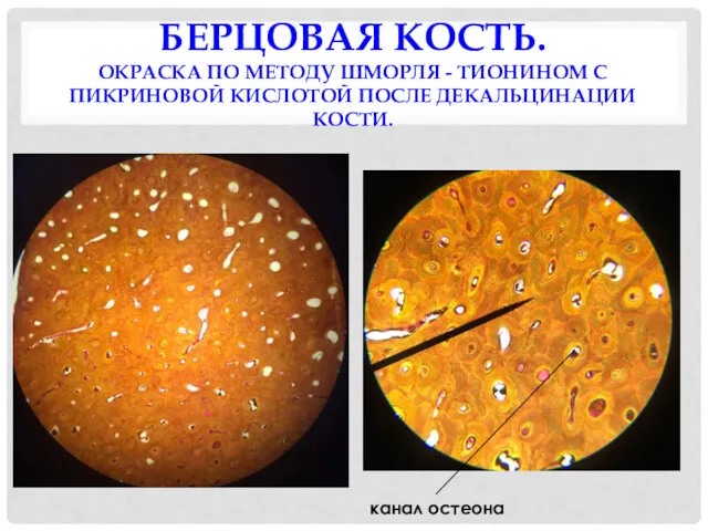 БЕРЦОВАЯ КОСТЬ. ОКРАСКА ПО МЕТОДУ ШМОРЛЯ - ТИОНИНОМ С ПИКРИНОВОЙ КИСЛОТОЙ ПОСЛЕ ДЕКАЛЬЦИНАЦИИ КОСТИ. канал остеона