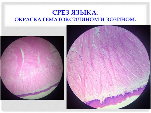 СРЕЗ ЯЗЫКА. ОКРАСКА ГЕМАТОКСИЛИНОМ И ЭОЗИНОМ.