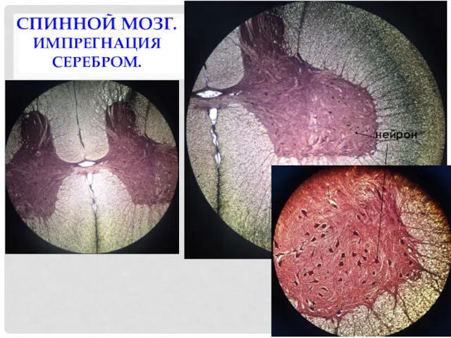 СПИННОЙ МОЗГ. ИМПРЕГНАЦИЯ СЕРЕБРОМ. нейрон