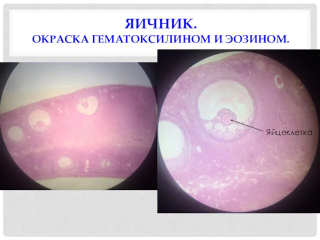 ЯИЧНИК. ОКРАСКА ГЕМАТОКСИЛИНОМ И ЭОЗИНОМ. Яйцеклетка