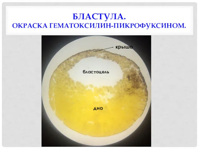 БЛАСТУЛА. ОКРАСКА ГЕМАТОКСИЛИН-ПИКРОФУКСИНОМ. крыша дно бластоцель