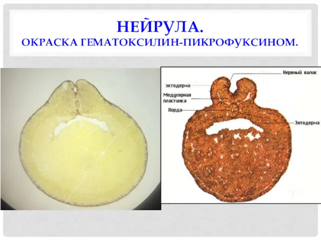 НЕЙРУЛА. ОКРАСКА ГЕМАТОКСИЛИН-ПИКРОФУКСИНОМ.