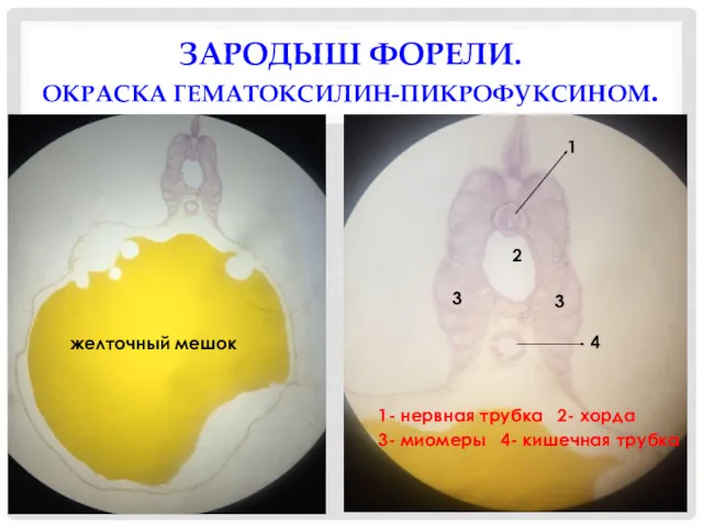 ЗАРОДЫШ ФОРЕЛИ. ОКРАСКА ГЕМАТОКСИЛИН-ПИКРОФУКСИНОМ. желточный мешок 1 2 3 3