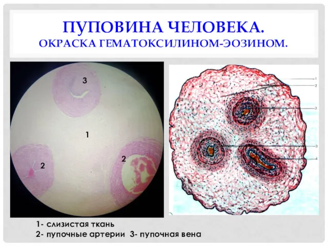 ПУПОВИНА ЧЕЛОВЕКА. ОКРАСКА ГЕМАТОКСИЛИНОМ-ЭОЗИНОМ. 1- слизистая ткань 2- пупочные артерии