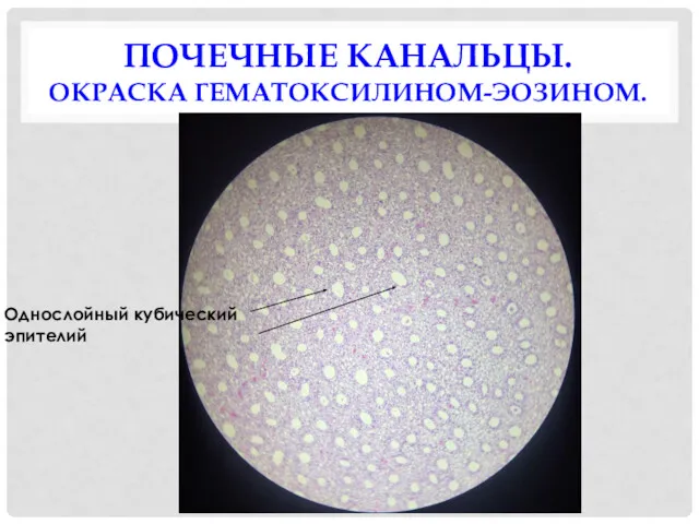 ПОЧЕЧНЫЕ КАНАЛЬЦЫ. ОКРАСКА ГЕМАТОКСИЛИНОМ-ЭОЗИНОМ. Однослойный кубический эпителий