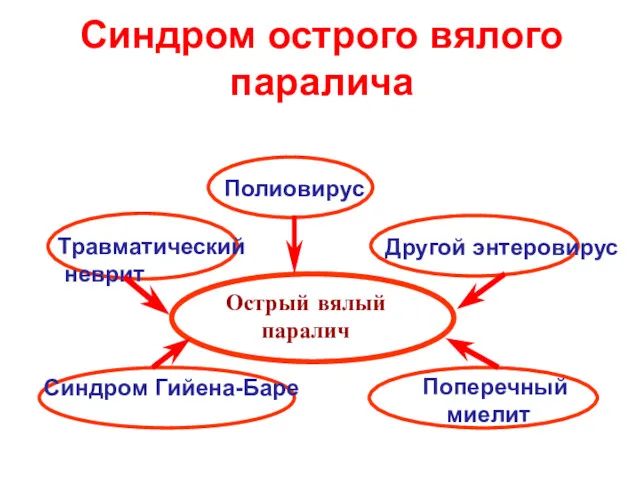 Синдром острого вялого паралича