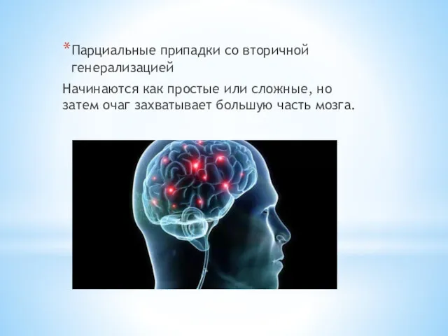 Парциальные припадки со вторичной генерализацией Начинаются как простые или сложные,