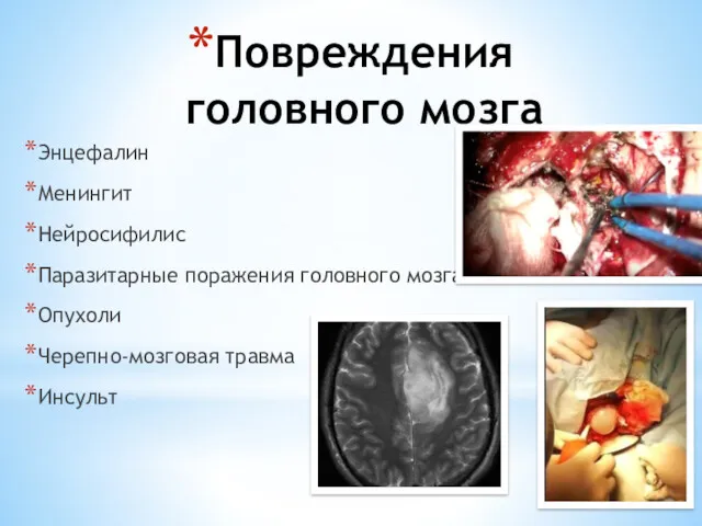 Повреждения головного мозга Энцефалин Менингит Нейросифилис Паразитарные поражения головного мозга Опухоли Черепно-мозговая травма Инсульт