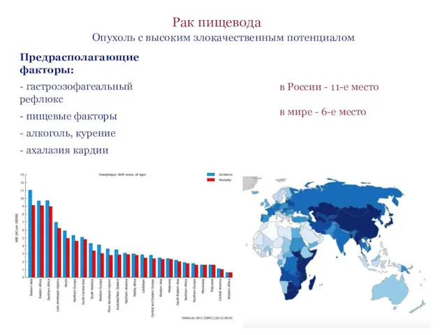 Рак пищевода в России - 11-е место в мире - 6-е место Опухоль