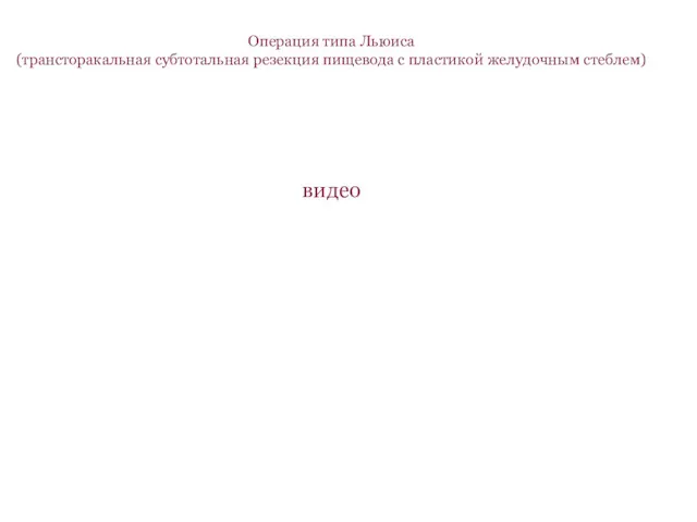 Операция типа Льюиса (трансторакальная субтотальная резекция пищевода с пластикой желудочным стеблем) видео