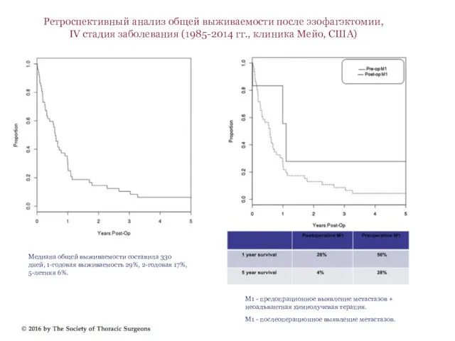Ретроспективный анализ общей выживаемости после эзофагэктомии, IV стадия заболевания (1985-2014
