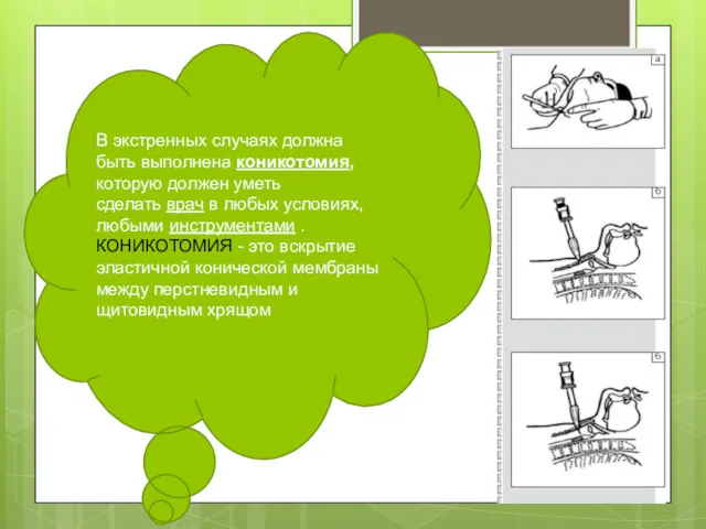 В экстренных случаях должна быть выполнена коникотомия, которую должен уметь