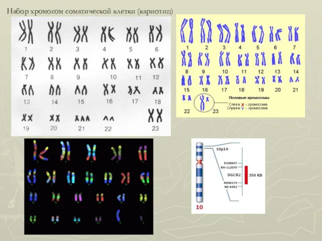Набор хромосом соматической клетки (кариотип)