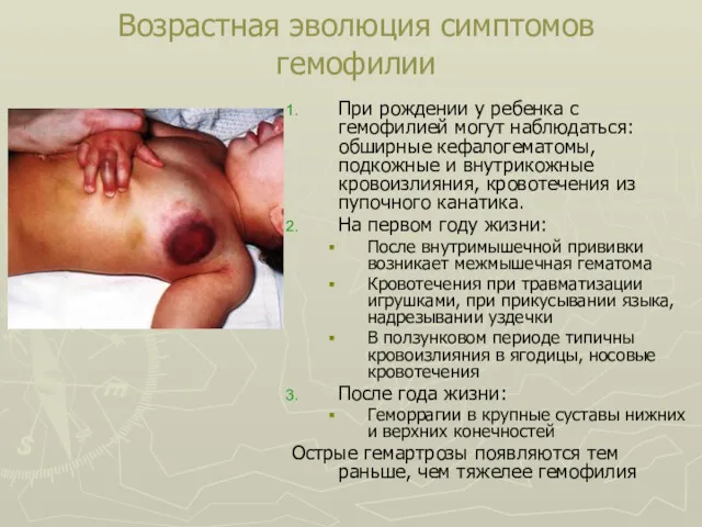 Возрастная эволюция симптомов гемофилии При рождении у ребенка с гемофилией