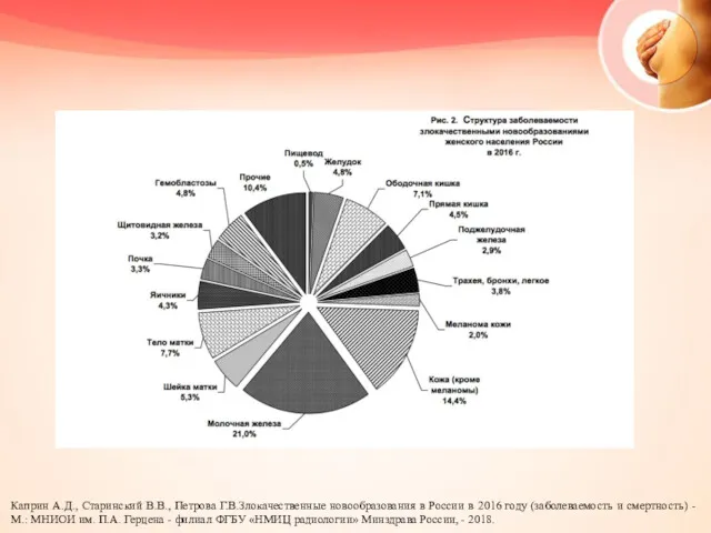 Каприн А.Д., Старинский В.В., Петрова Г.В.Злокачественные новообразования в России в 2016 году (заболеваемость