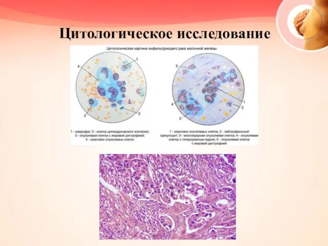 Цитологическое исследование