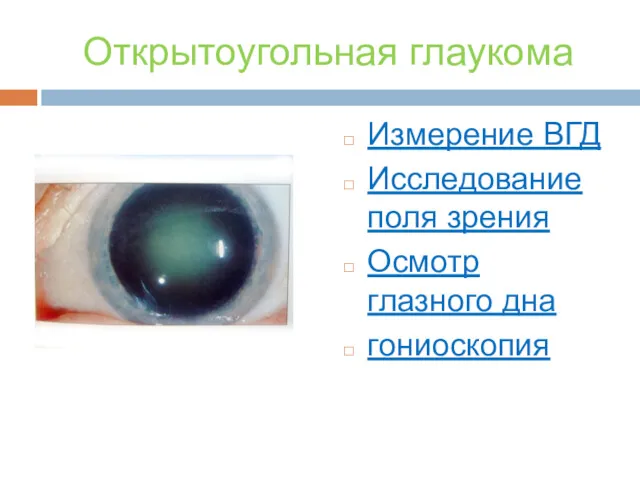 Открытоугольная глаукома Измерение ВГД Исследование поля зрения Осмотр глазного дна гониоскопия