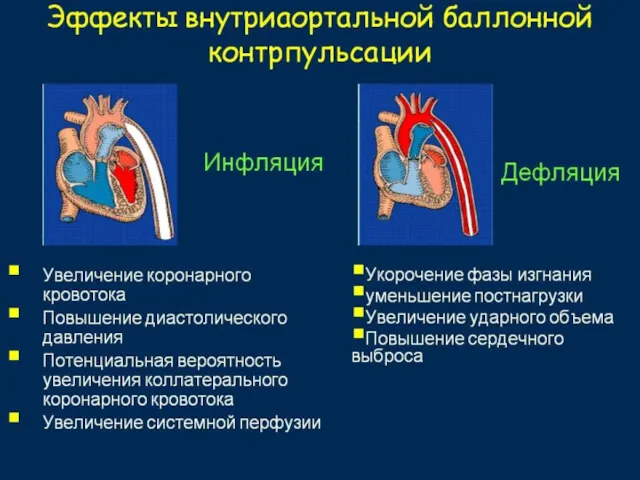 Суть метода состоит в введении через бедренную артерию в аорту