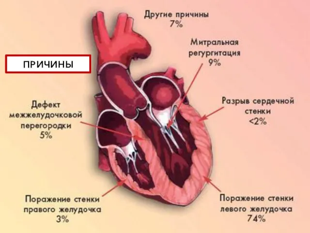 ПРИЧИНЫ