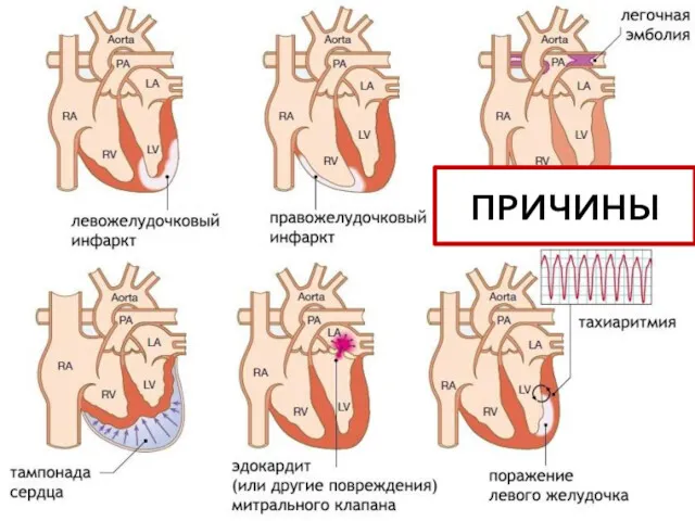 ПРИЧИНЫ