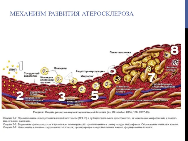 МЕХАНИЗМ РАЗВИТИЯ АТЕРОСКЛЕРОЗА